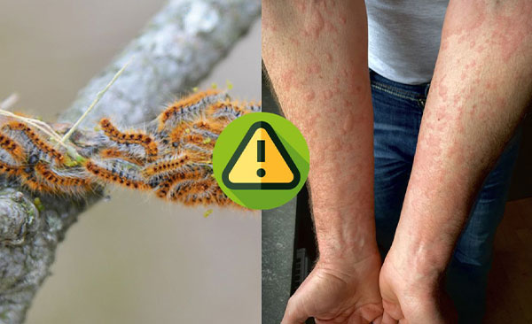 Contrôle-des-Chenilles-Processionnaires-3